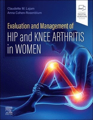 Evaluation and Management of Hip and Knee Arthritis in Women