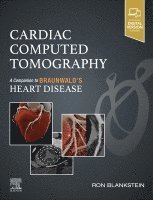 Ron Blankstein - Cardiac Computed Tomography, Inbunden