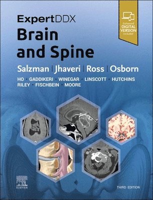 Karen L. Salzman, Miral D. Jhaveri, Jeffrey S. Ross - ExpertDDx: Brain and Spine, Inbunden