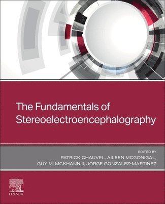 The Fundamentals of Stereoelectroencephalography 1