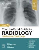 Ali B.A.K. Al-Hadithi, Zeshan Qureshi - The Unofficial Guide to Radiology: 100 Practice Chest X-rays, Häftad