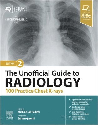 The Unofficial Guide to Radiology: 100 Practice Chest X-rays 1