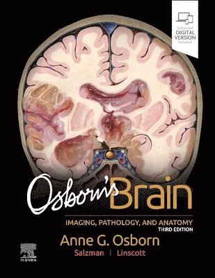 Anne G. Osborn, Luke L. Linscott, Karen L. Salzman - Osborn's Brain, Inbunden