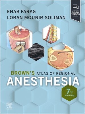 Brown's Atlas of Regional Anesthesia 1