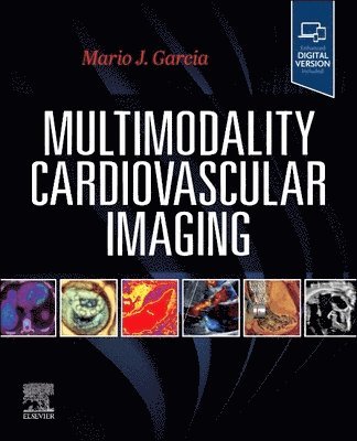 Mario J. Garcia, USA) Garcia, Mario J. (Professor, Department of Medicine, Pauline Levitt Chair in Medicine, Chief, Department of Medicine Division of Cardiology, Co-Director, Montefiore Einstein Center for Heart and Vascular Care, Albert Einstein College of Medicine, Bronx, New York - Multimodality Cardiovascular Imaging, Häftad