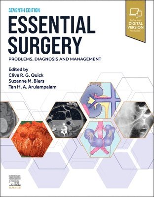 Essential Surgery 1