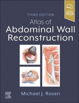 bokomslag Atlas of Abdominal Wall Reconstruction