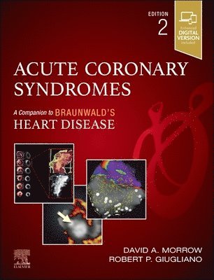 bokomslag Acute Coronary Syndromes