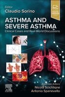 Claudio Sorino - Asthma and Severe Asthma, Häftad
