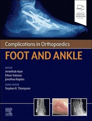 Amiethab Aiyer, Ettore Vulcano, Jonathan Kaplan - Complications in Orthopaedics: Foot and Ankle, Inbunden