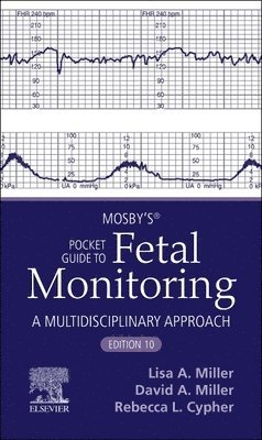 Mosby's� Pocket Guide to Fetal Monitoring