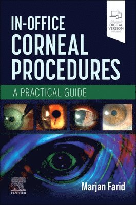 In-Office Corneal Procedures 1