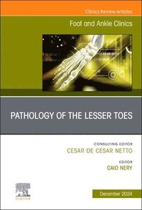 bokomslag Pathology of the Lesser Toes, An issue of Foot and Ankle Clinics of North America