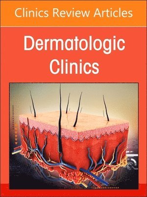 bokomslag Psoriasis: Contemporary and Future Therapies, An Issue of Dermatologic Clinics