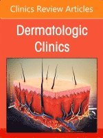 Psoriasis: Contemporary and Future Therapies, An Issue of Dermatologic Clinics