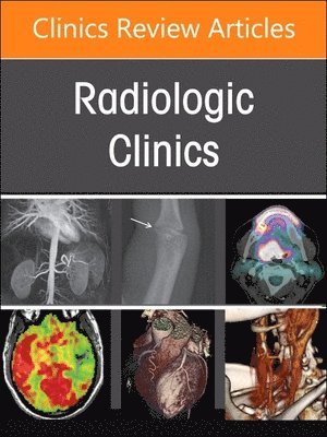 Spine Imaging and Intervention, An Issue of Radiologic Clinics of North America 1