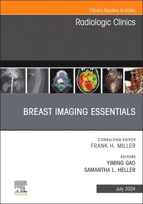 bokomslag Breast Imaging Essentials, An Issue of Radiologic Clinics of North America