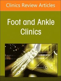bokomslag Updates in Hallux Rigidus, An issue of Foot and Ankle Clinics of North America