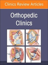 bokomslag Arthritis and Related Conditions, An Issue of Orthopedic Clinics