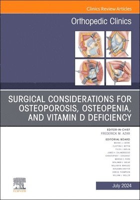 Surgical Considerations for Osteoporosis, Osteopenia, and Vitamin D Deficiency, An Issue of Orthopedic Clinics 1