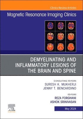 Demyelinating and Inflammatory Lesions of the Brain and Spine, An Issue of Magnetic Resonance Imaging Clinics of North America 1