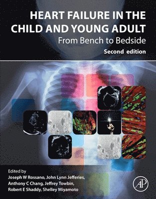 Joseph Rossano, Joseph Rossano, John Lynn Jefferies, Anthony C. Chang, Jeffrey A. Towbin, Robert E Shaddy, Shelley Miyamoto - Heart Failure in the Child and Young Adult, Häftad