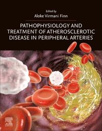 bokomslag Pathophysiology and Treatment of Atherosclerotic Disease in Peripheral Arteries