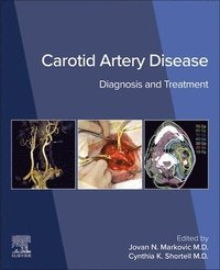 bokomslag Carotid Artery Disease