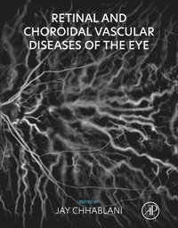 bokomslag Retinal and Choroidal Vascular Diseases of the Eye