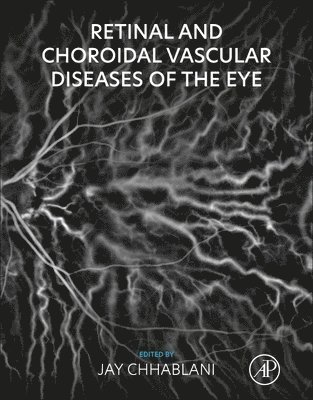 Retinal and Choroidal Vascular Diseases of the Eye 1