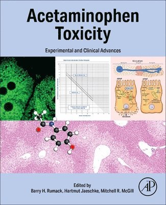 bokomslag Acetaminophen Toxicity