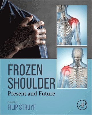 bokomslag Frozen Shoulder