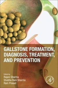 bokomslag Gallstone Formation, Diagnosis, Treatment and Prevention