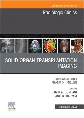 bokomslag Solid organ transplantation imaging, An Issue of Radiologic Clinics of North America