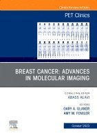 Gary A. Ulaner, Amy M. Fowler - Breast Cancer: Advances in Molecular Imaging, An Issue of PET Clinics, Inbunden