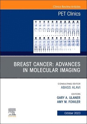 bokomslag Breast Cancer: Advances in Molecular Imaging, An Issue of PET Clinics