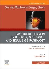 bokomslag Imaging of Common Oral Cavity, Sinonasal, and Skull Base Pathology, An Issue of Oral and Maxillofacial Surgery Clinics of North America