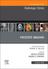 bokomslag Prostate Imaging, An Issue of Radiologic Clinics of North America