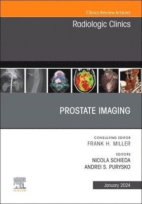 bokomslag Prostate Imaging, An Issue of Radiologic Clinics of North America