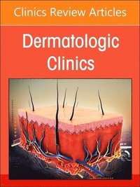 bokomslag Neutrophilic Dermatoses, An Issue of Dermatologic Clinics