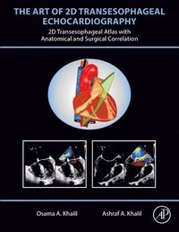 bokomslag The Art of 2D Transesophageal Echocardiography