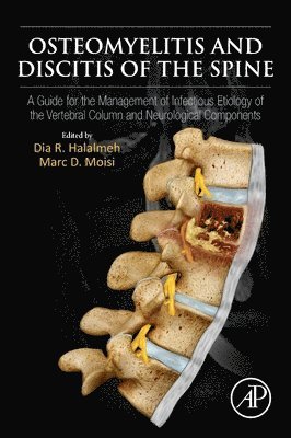 Dia R Halalmeh, Marc Moisi, Dia R. Halalmeh - Osteomyelitis and Discitis of the Spine, Häftad