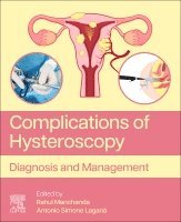 Rahul Manchanda, Antonio Simone Lagan� - Complications of Hysteroscopy, Häftad