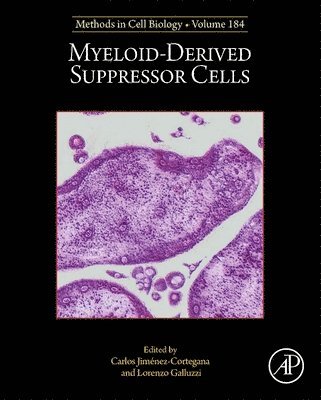 Myeloid-Derived Suppressor Cells 1