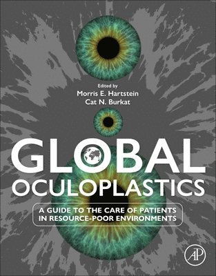 bokomslag Global Oculoplastics