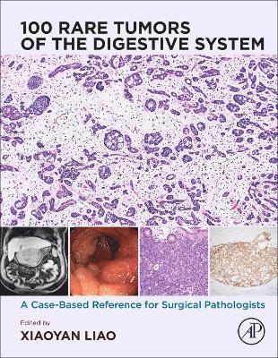 100 Rare Tumors of the Digestive System 1