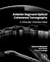 Mehmet Baykara, Berna Akova, M. �mer Kiristioglu, M. Ömer Kırıştıoğlu, K& - Anterior Segment Optical Coherence Tomography, Häftad