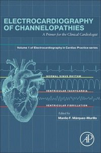 bokomslag Electrocardiography of Channelopathies