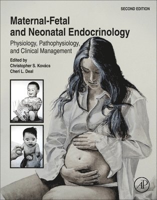Christopher S. Kov�cs, Cheri L. Deal - Maternal-Fetal and Neonatal Endocrinology, Inbunden