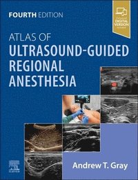 bokomslag Atlas of Ultrasound-Guided Regional Anesthesia